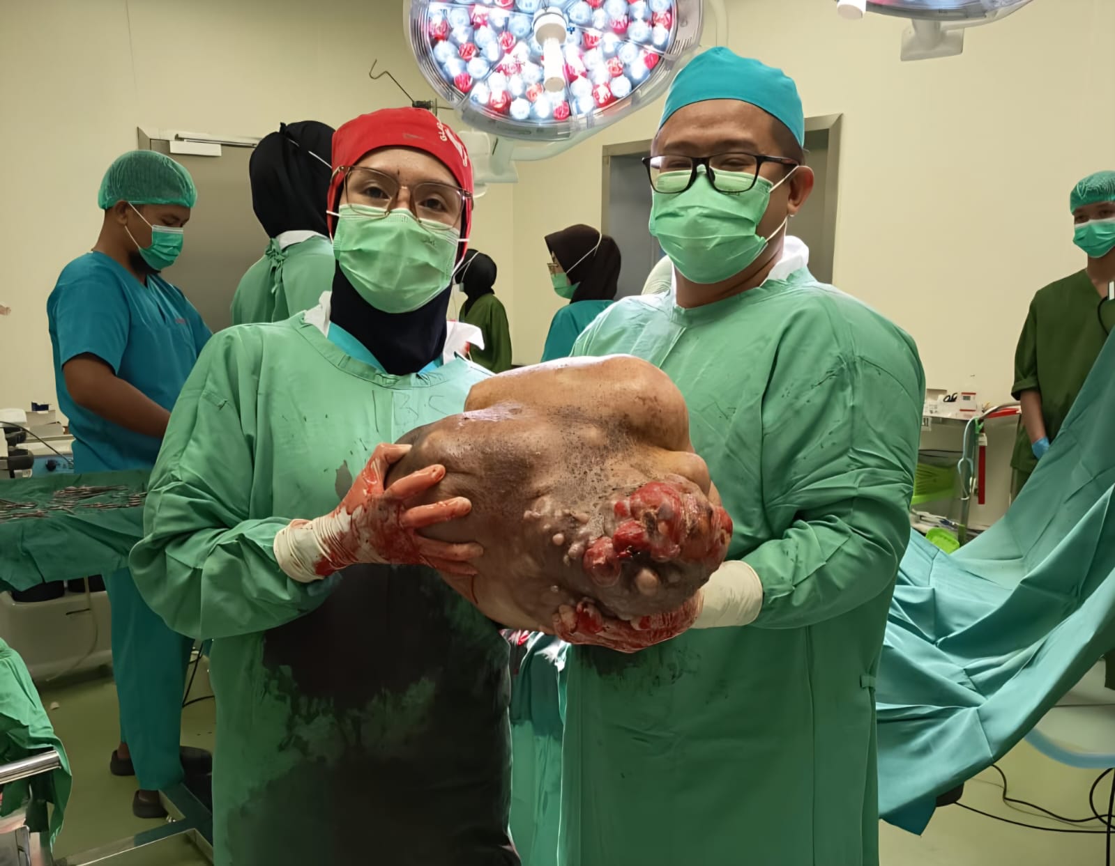 Laporan Warga Ditindak Cepat, Hj. Erna Lisa Halaby Instruksikan RS Idaman Tangani Pasien Tumor Payudara